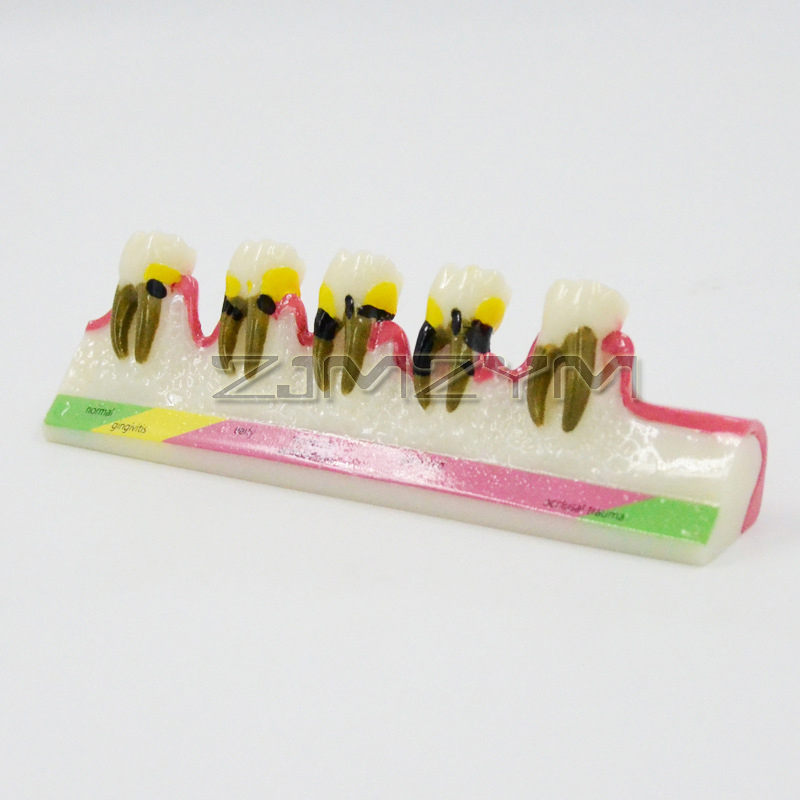 Periodontal Disease Model Dent - đánh giá và giá Medical Lab Study